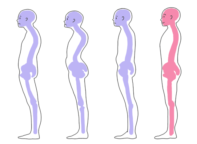 姿勢の悪い様々な人の図